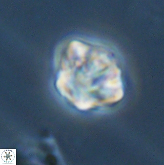 Olladiscoaster perplexus 32385