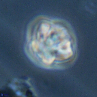 Olladiscoaster perplexus 32386