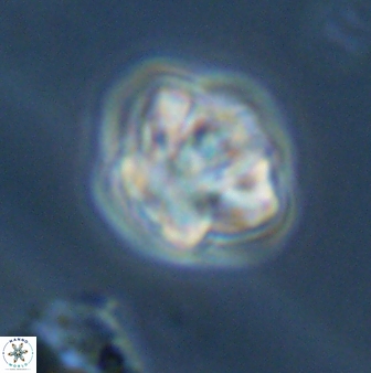 Olladiscoaster perplexus 32386