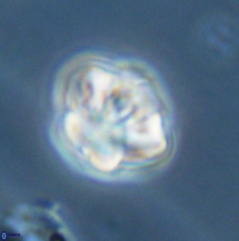 Olladiscoaster perplexus 32387