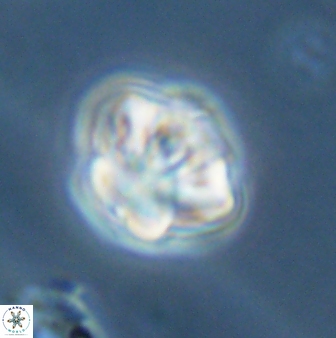 Olladiscoaster perplexus 32387