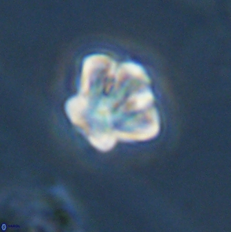 Olladiscoaster perplexus 32388