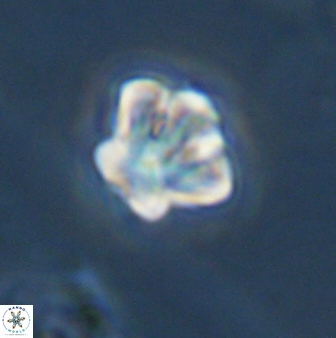 Olladiscoaster perplexus 32388