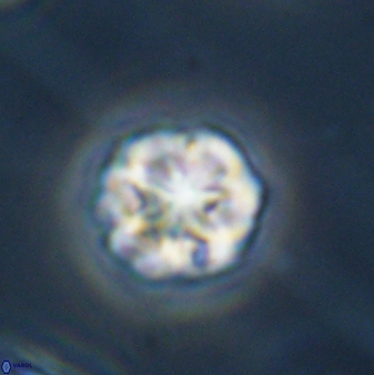 Olladiscoaster perplexus 32389