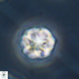 Olladiscoaster perplexus 32389
