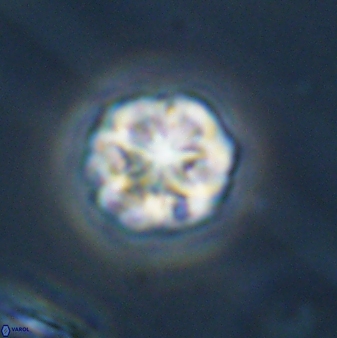 Olladiscoaster perplexus 32390