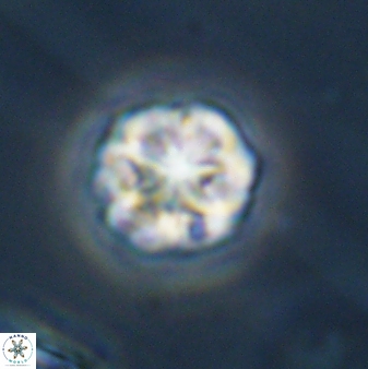 Olladiscoaster perplexus 32390
