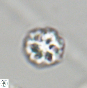 Olladiscoaster perplexus 32391
