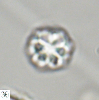 Olladiscoaster perplexus 32392