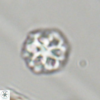 Olladiscoaster perplexus 32394