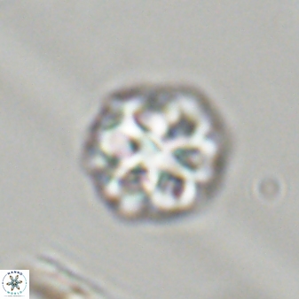 Olladiscoaster perplexus 32395