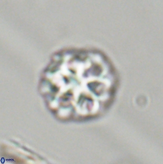 Olladiscoaster perplexus 32397