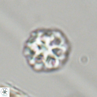Olladiscoaster perplexus 32397
