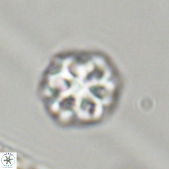 Olladiscoaster perplexus 32398