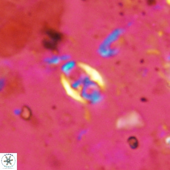 Orastrum partitum VR 14190