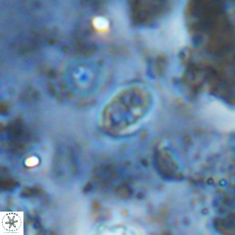 Orastrum partitum VR 14204