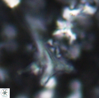 Orthorhabdus serratus 14262