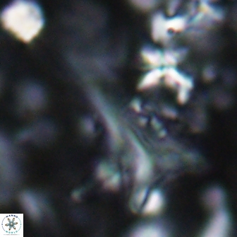 Orthorhabdus serratus 14265