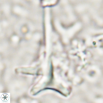 Orthorhabdus serratus 14270