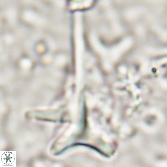Orthorhabdus serratus 14271