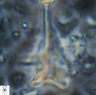 Orthorhabdus serratus 14272