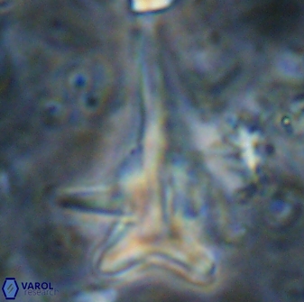Orthorhabdus serratus 14273