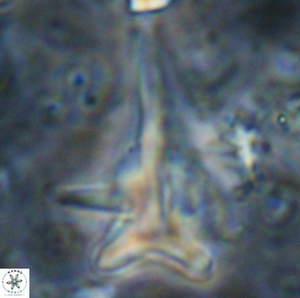 Orthorhabdus serratus 14273