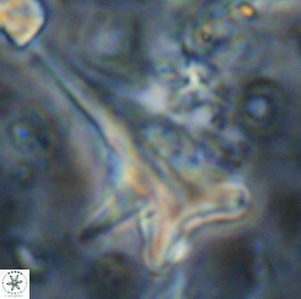 Orthorhabdus serratus 14274