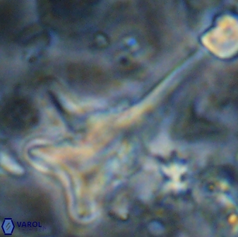 Orthorhabdus serratus 14275