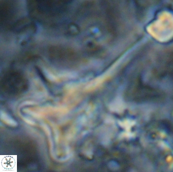 Orthorhabdus serratus 14275