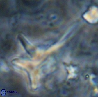 Orthorhabdus serratus 14276