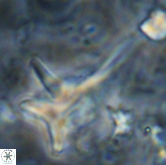 Orthorhabdus serratus 14276