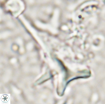 Orthorhabdus serratus 14277