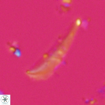 Orthorhabdus serratus 22727