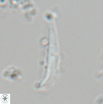 Orthorhabdus serratus 22728