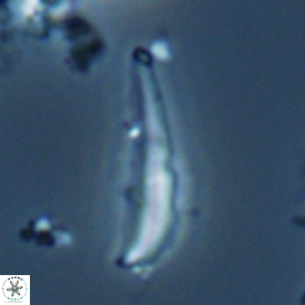 Orthorhabdus serratus 22729