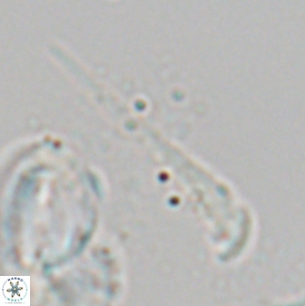 Orthorhabdus serratus 27659