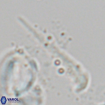 Orthorhabdus serratus 27660