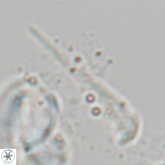 Orthorhabdus serratus 27660