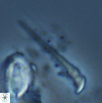 Orthorhabdus serratus 27661