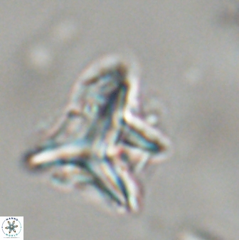 Orthorhabdus serratus 30343