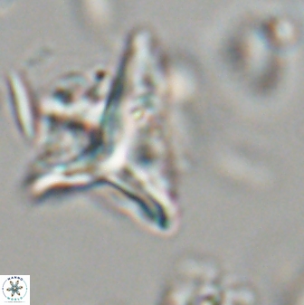 Orthorhabdus serratus 30346