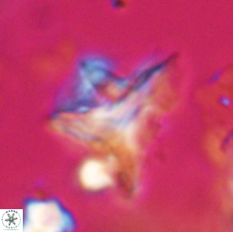 Orthorhabdus serratus 30349