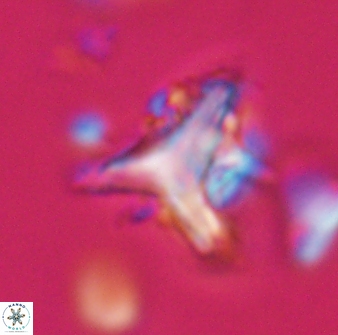 Orthorhabdus serratus 30351