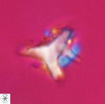 Orthorhabdus serratus 30352