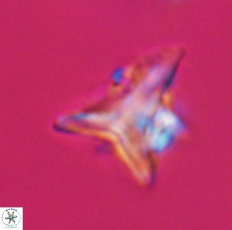 Orthorhabdus serratus 30358
