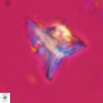 Orthorhabdus serratus 30363