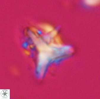 Orthorhabdus serratus 30367
