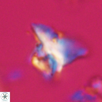 Orthorhabdus serratus 30369