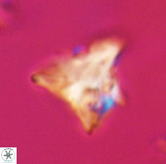 Orthorhabdus serratus 30372